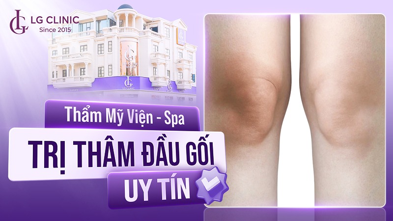 Spa trị thâm đầu gối uy tín