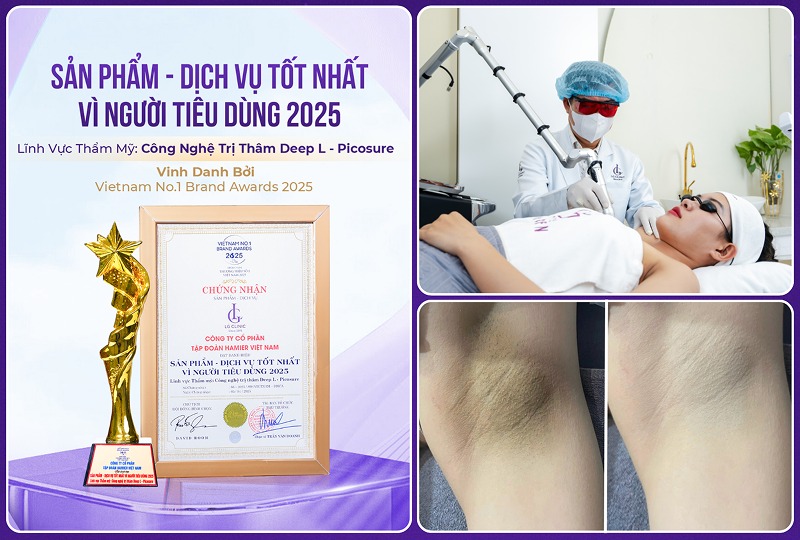 Spa trị thâm ở Vũng Tàu