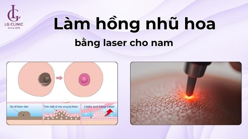 Cách làm hồng nhũ hoa cho nam giới