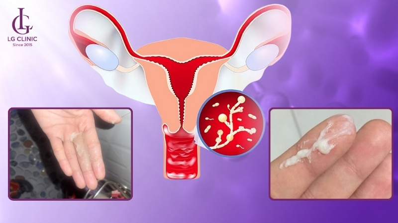 giai đoạn trung bình