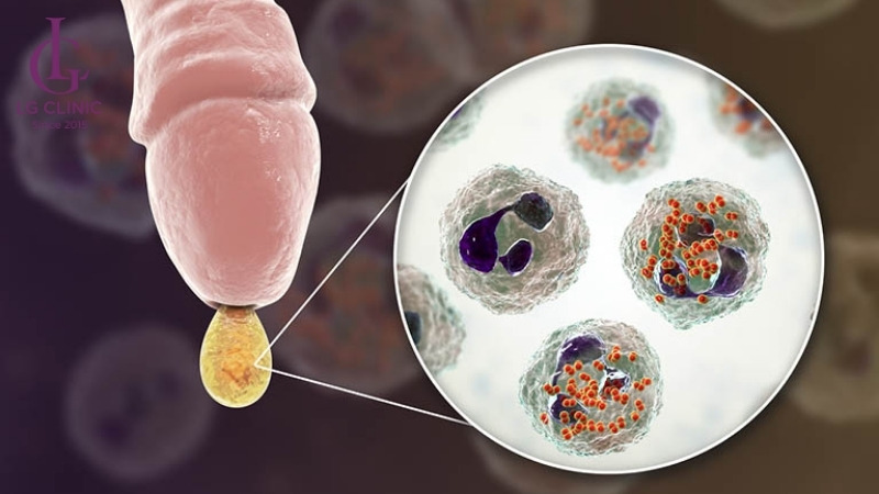 ngứa do viêm bao quay đầu