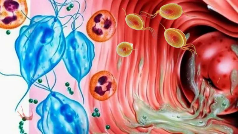 ngứa vùng kín do trùng roi