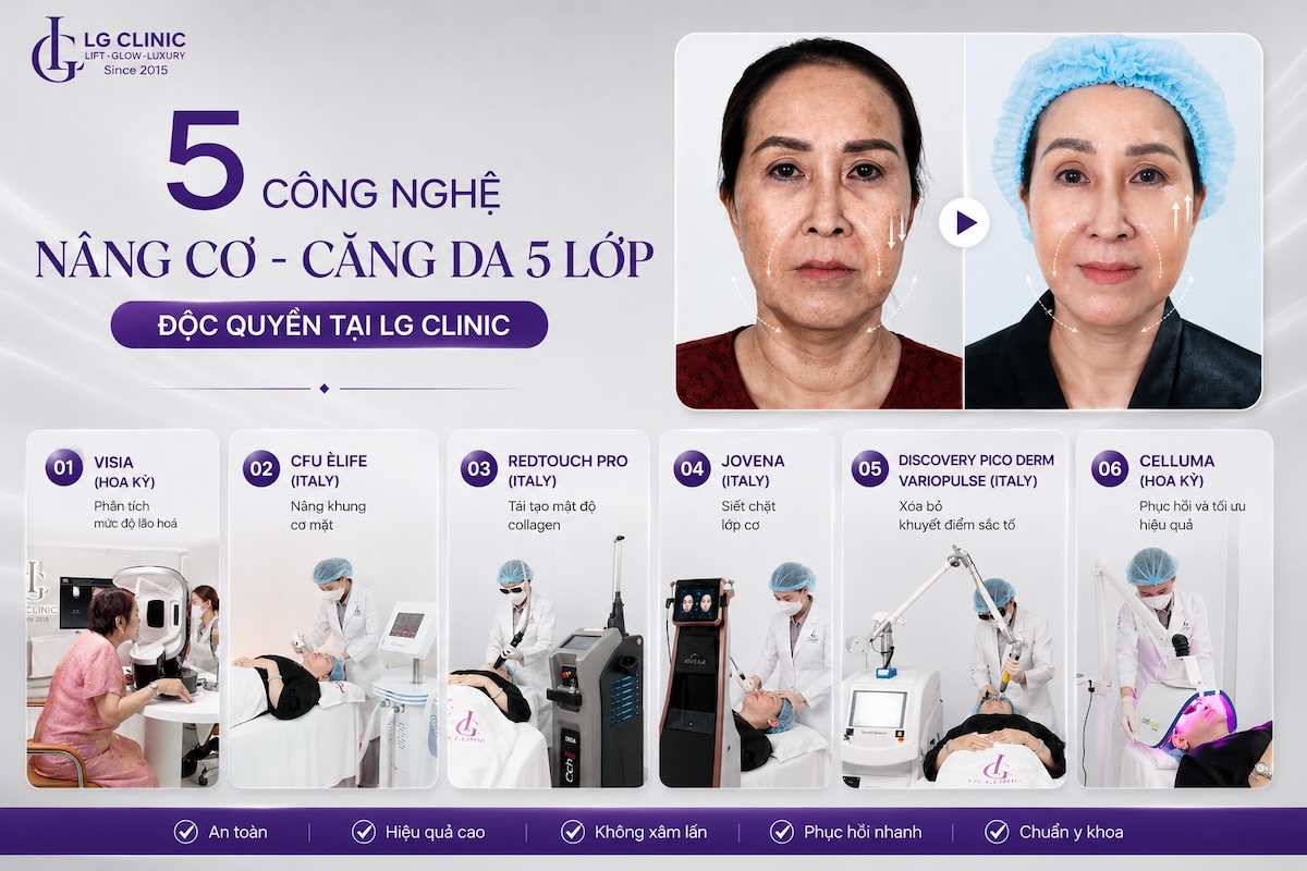 5 công nghệ nâng cơ căng da 5 lớp