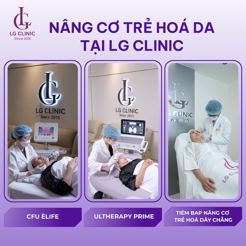 nâng cơ mặt tại lg clinic