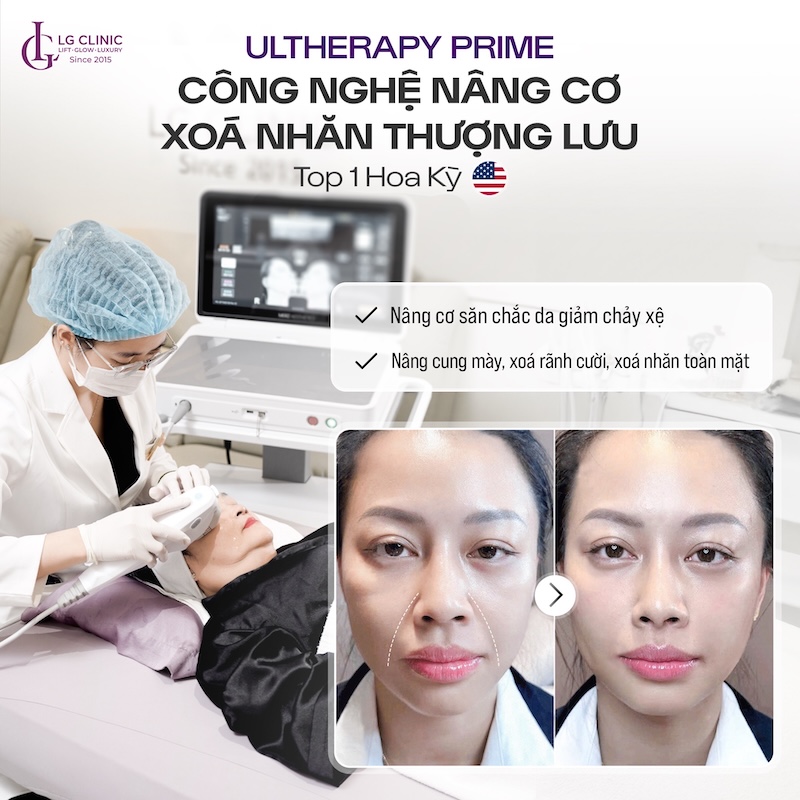nâng cơ trẻ hoá da ultherapy prime