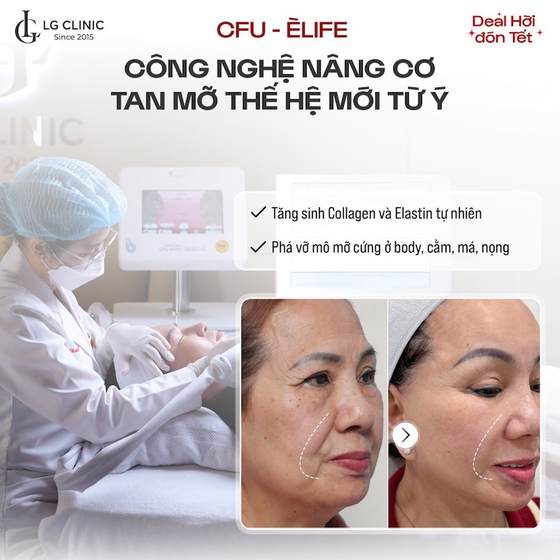 nâng cơ trẻ hoá da mặt cfu elife