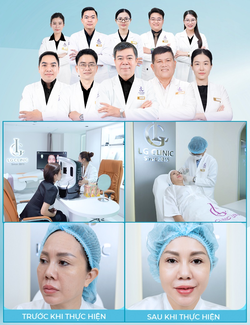 lg clinic là đơn vị tiêm bap luhilo uy tín