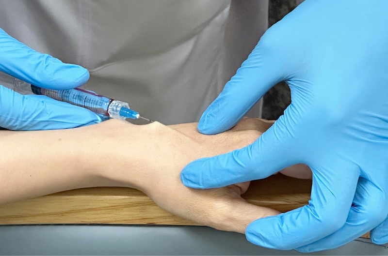 tiêm trẻ hoá bàn tay