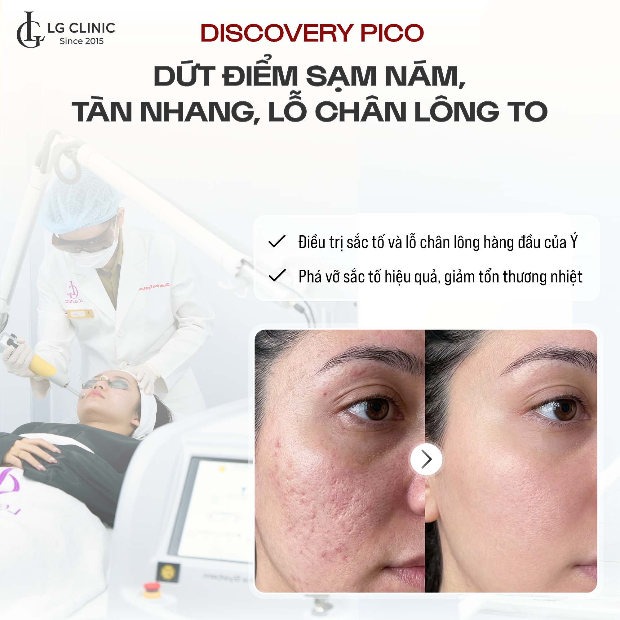 Trẻ hoá da mặt với công nghệ Laser Pico