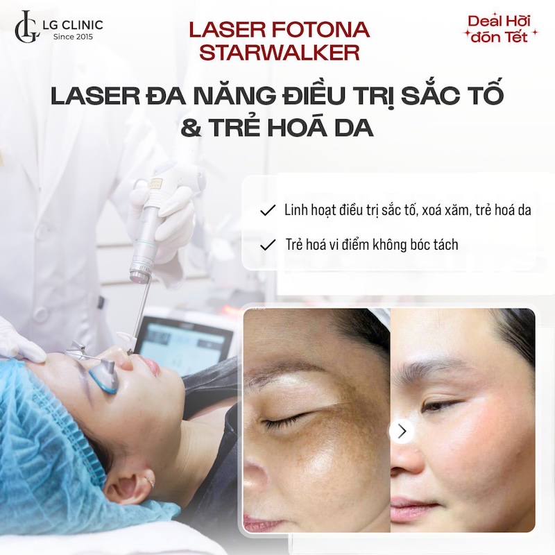 laser trẻ hoá da