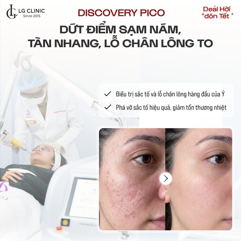 trẻ hóa da bằng laser