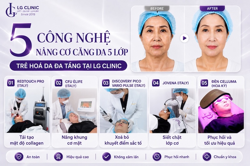 trẻ hoá da đa tầng