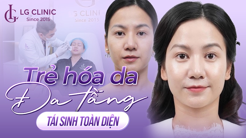 Trẻ hóa da đa tầng