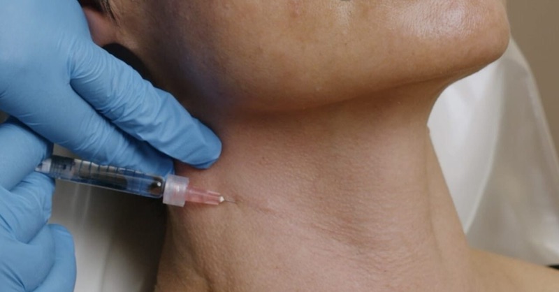 tiêm trẻ hoá vùng da cổ