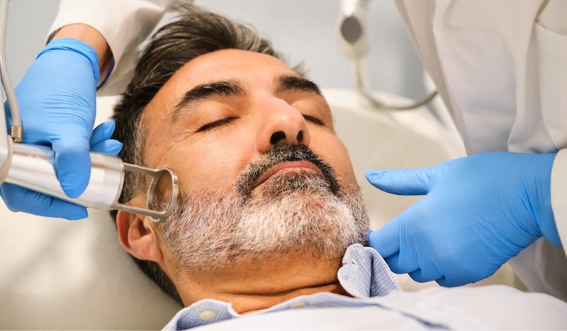 trẻ hoá da cho nam bằng laser 