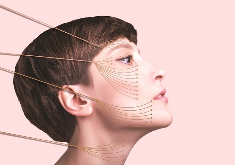 căng chỉ da mặt