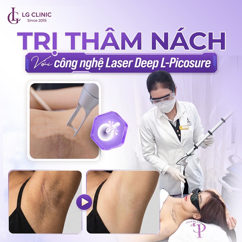 trị thâm nách