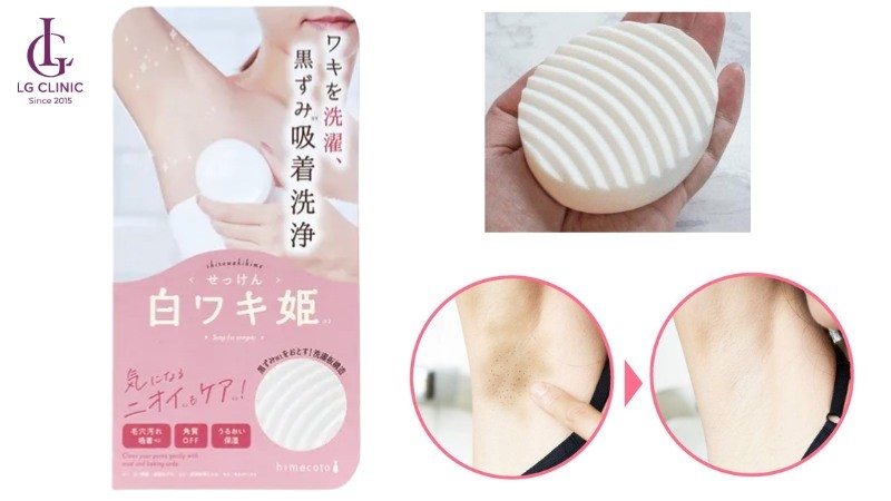 xà bông trị thâm nách