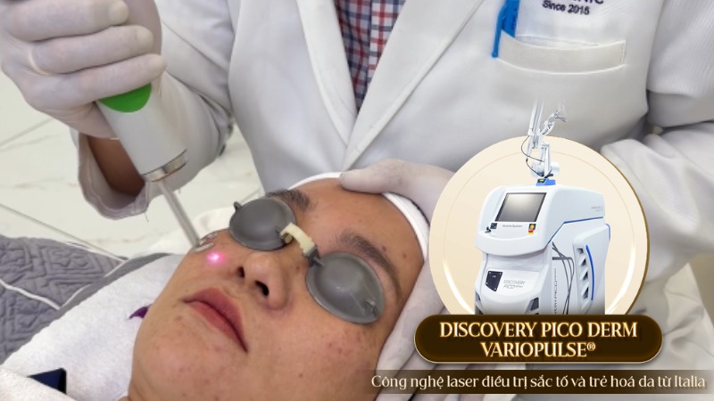 bắn discovery trị thâm