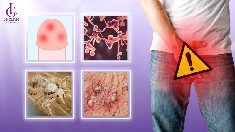 Nguyên nhân bệnh lý gây ngứa vùng kín nam giới