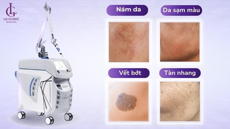 Discovery Pico là gì