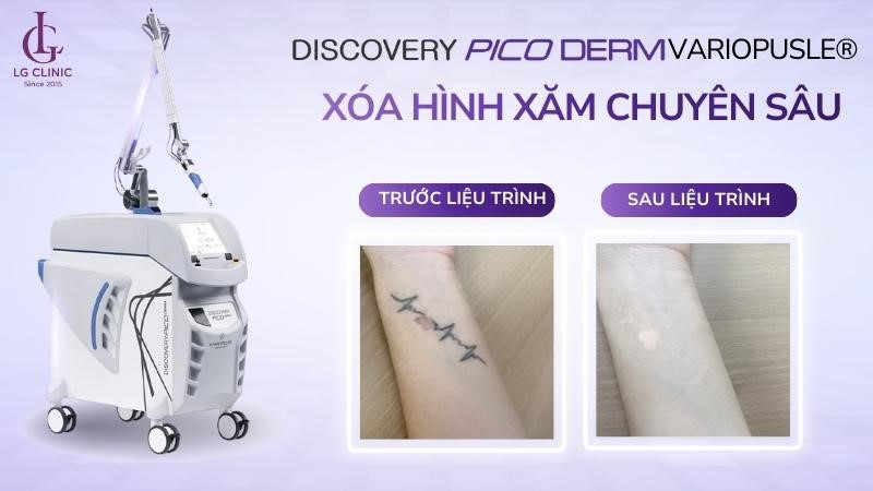 Discovery Pico là gì