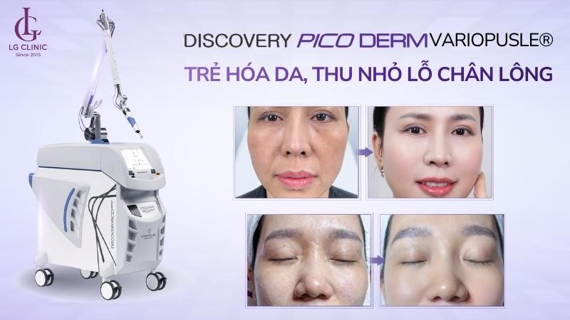 Discovery Pico là gì