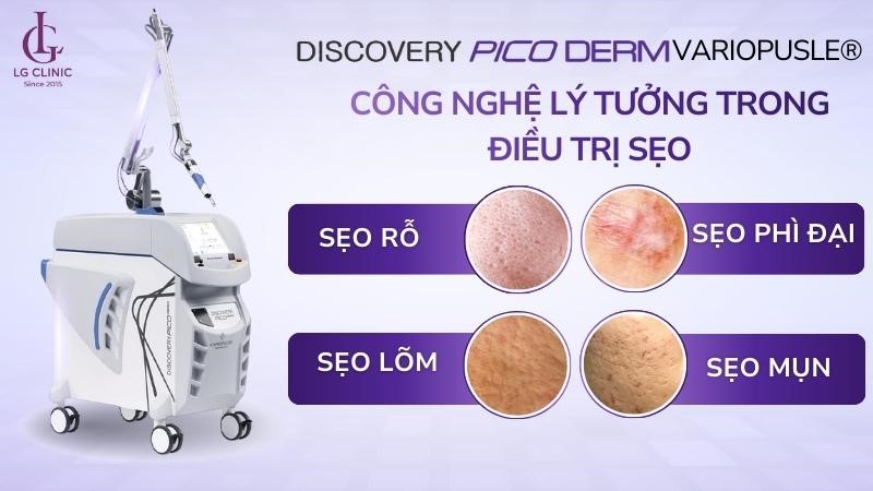 Discovery Pico là gì