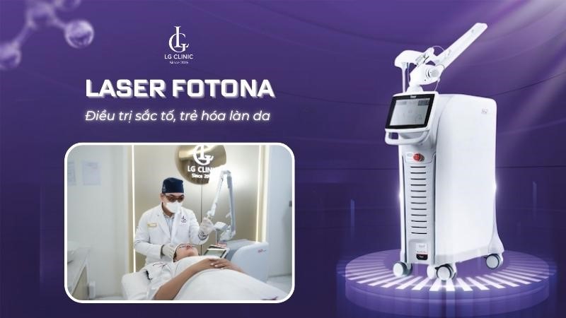 laser fotona