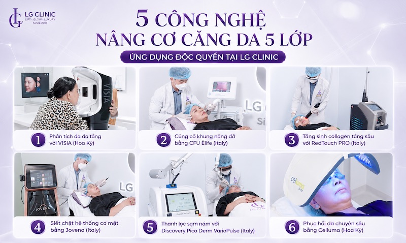 nâng cơ mặt bằng công nghệ nào tốt nhất