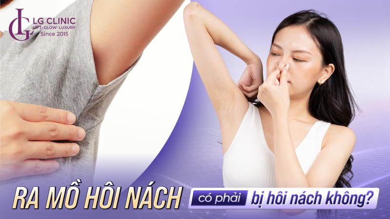 ra mồ hôi nách có phải bị hôi nách