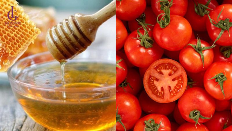 sau bắn laser da bị thâm