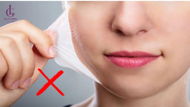 sau bắn laser da bị thâm