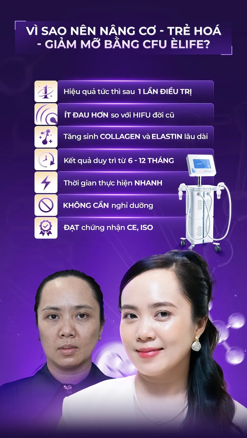 vì sao nên chọn cfu