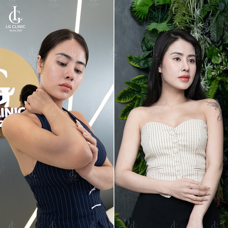 Spa tắm trắng quận 11