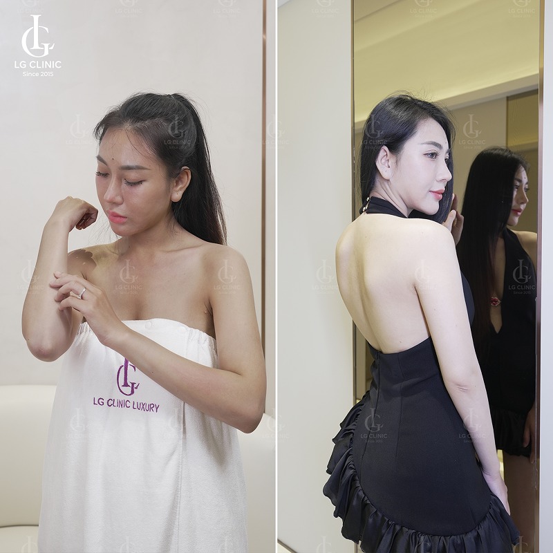 Spa tắm trắng quận 12