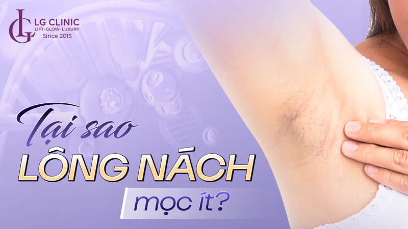 tại sao lông nách mọc ít