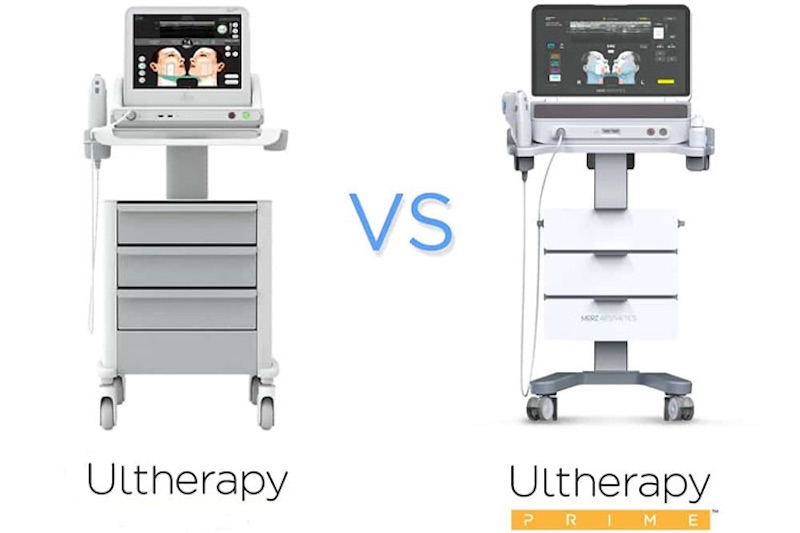 ultherapy và ultherapy prime