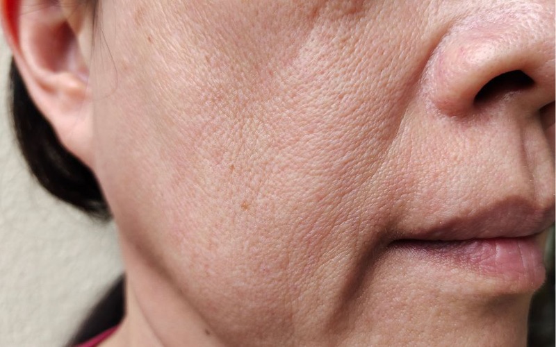 đối tượng nên sử dụng trẻ hoá da mặt