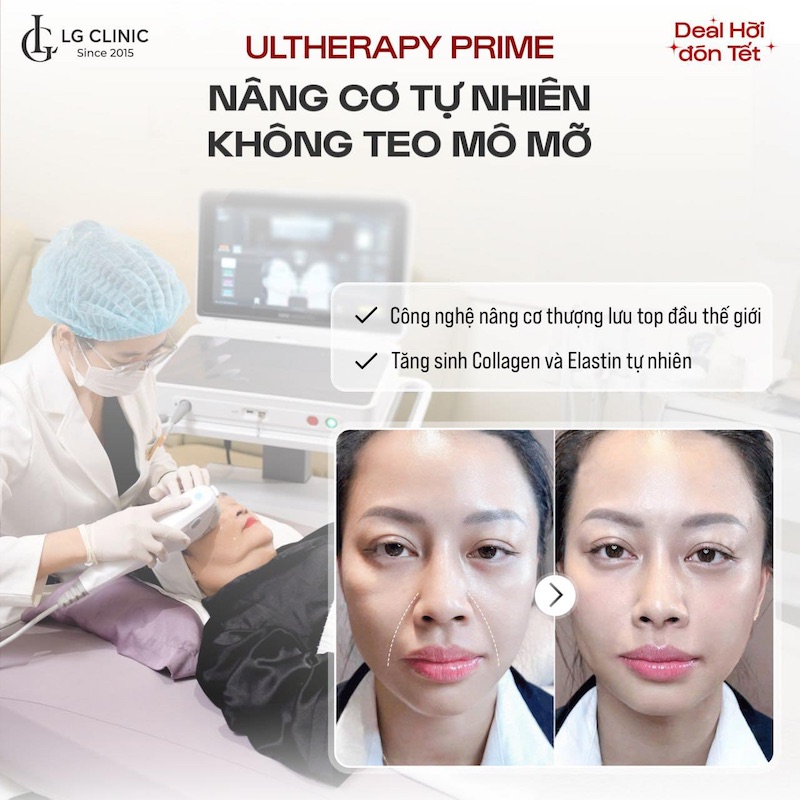 Ultherapy Prime