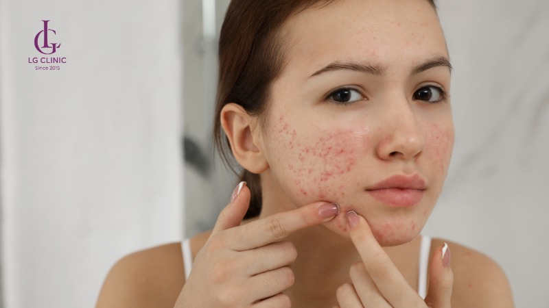 dịch vụ thu nhỏ lỗ chân lông