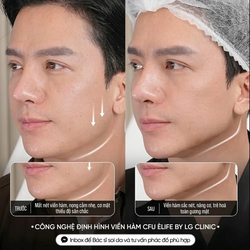 Hình ảnh khách hàng nâng cơ cfu