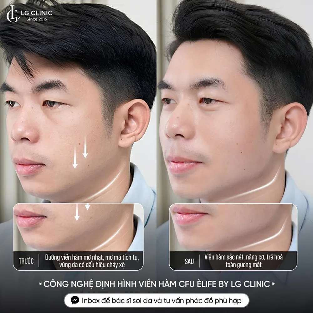 Hình ảnh khách hàng nâng cơ cfu