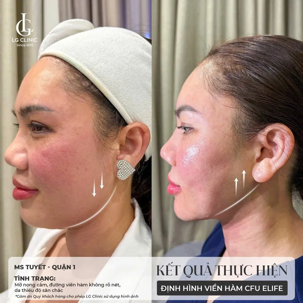 Hình ảnh khách hàng nâng cơ cfu