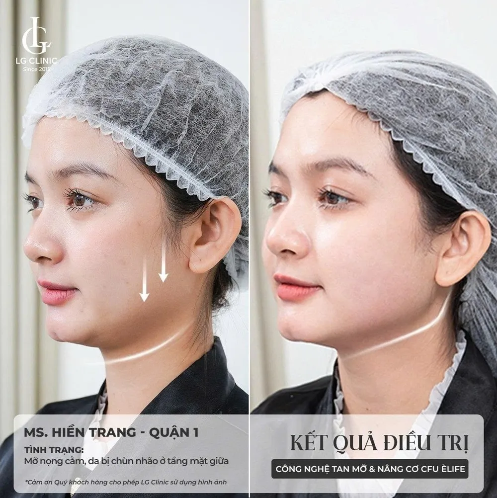 Hình ảnh khách hàng nâng cơ cfu