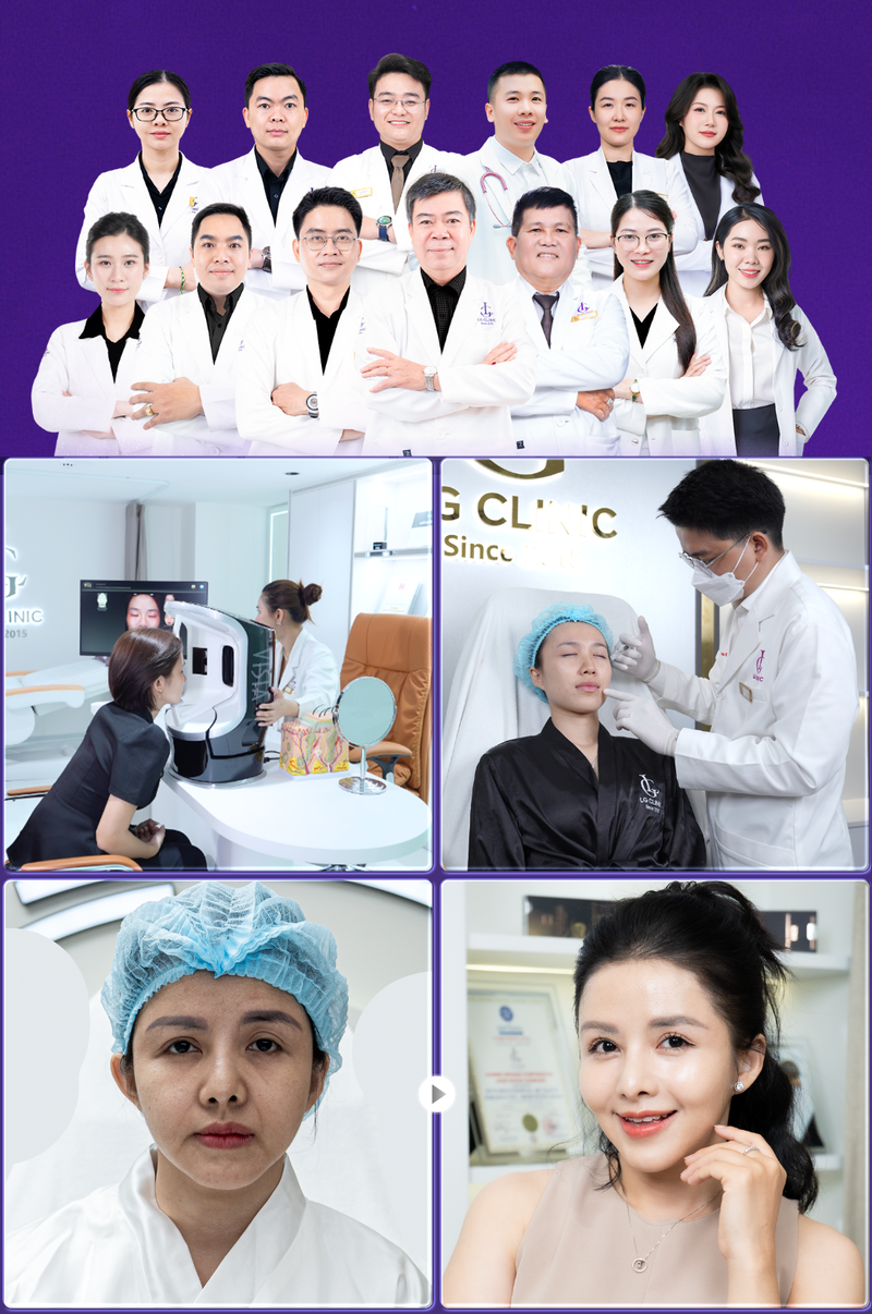 địa chỉ xoá nếp nhăn dưới mắt