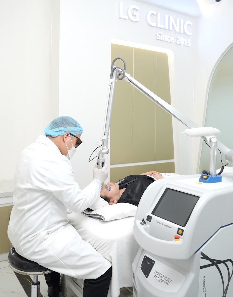 xoá nếp nhăn giữa 2 chân mày bằng laser