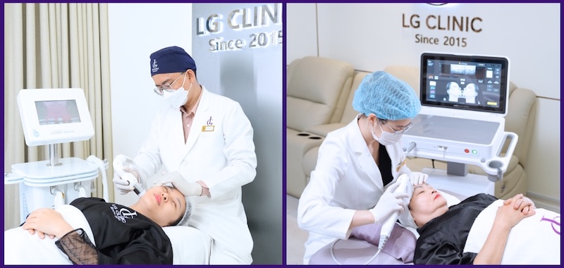 xoá nếp nhăn mũi bằng công nghệ nâng cơ