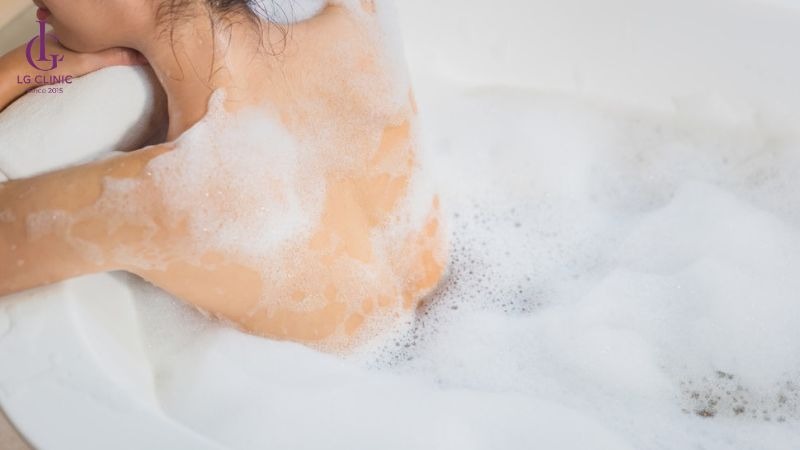 Ra mồ hôi nách có phải bị hôi nách không