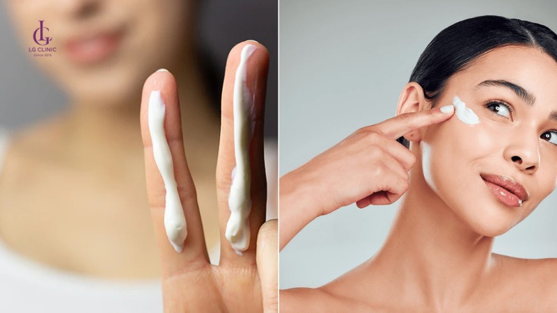 sau khi bắn laser có được rửa mặt không